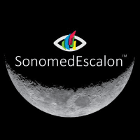 ESCALON MEDICAL CORP [ESMC]  posts $0.01M loss as revenue rises 15.38% to $3.01M